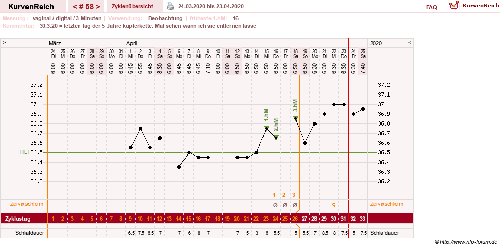 NFP-Kurve User #27863