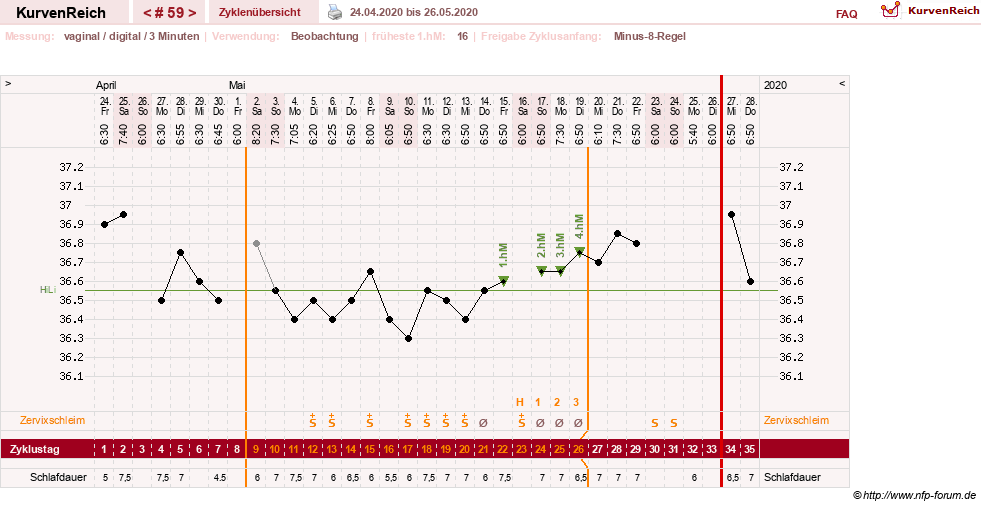 NFP-Kurve User #27863