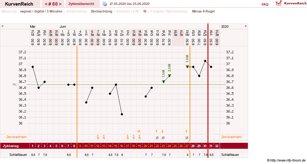 NFP-Kurve User #27863