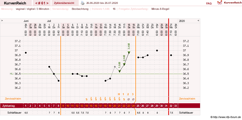 NFP-Kurve User #27863