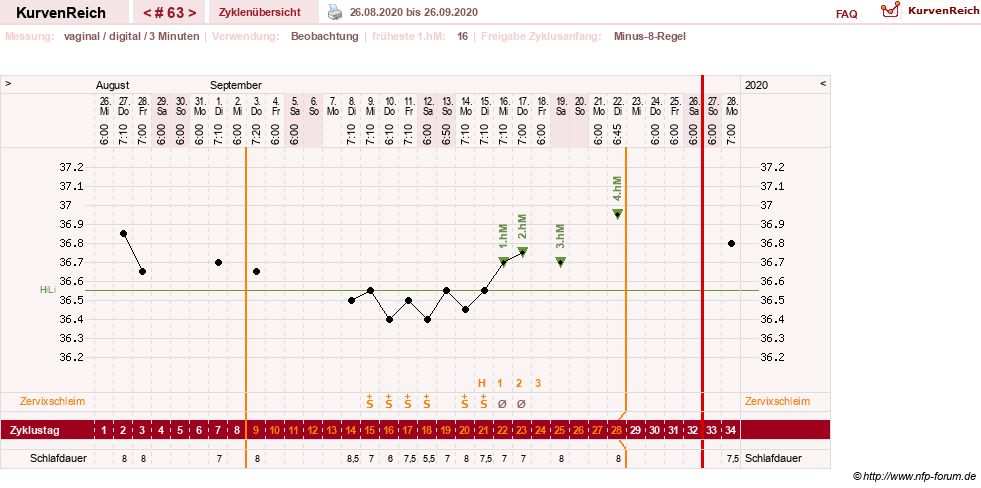 NFP-Kurve User #27863