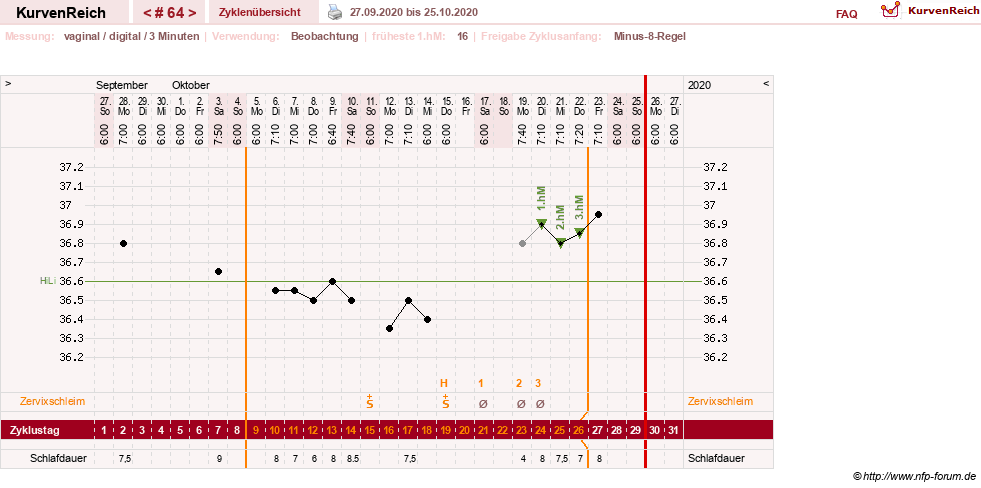 NFP-Kurve User #27863