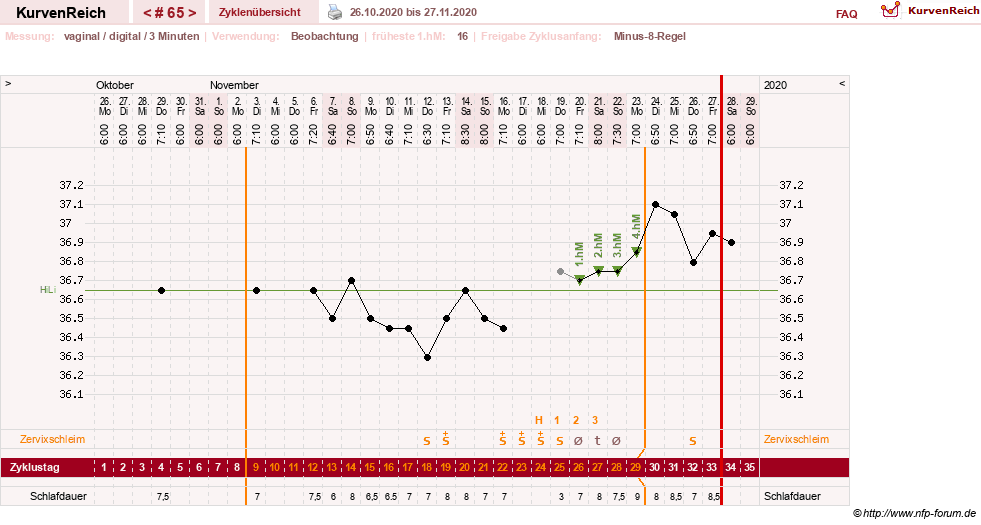 NFP-Kurve User #27863
