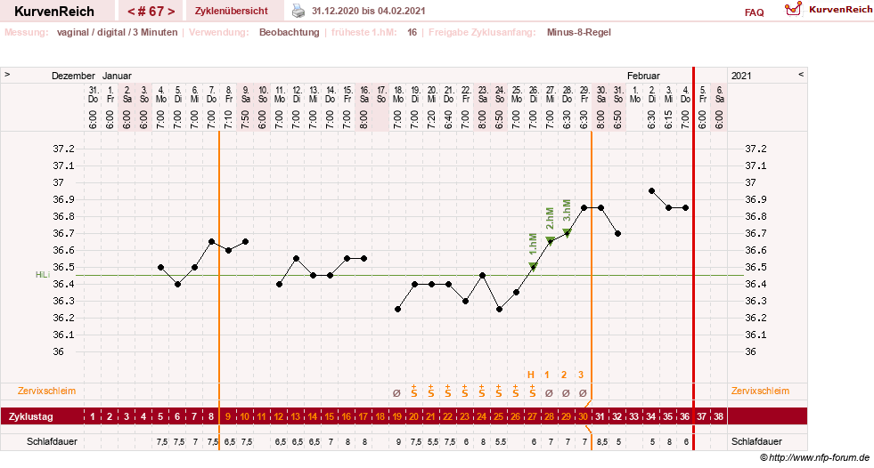 NFP-Kurve User #27863