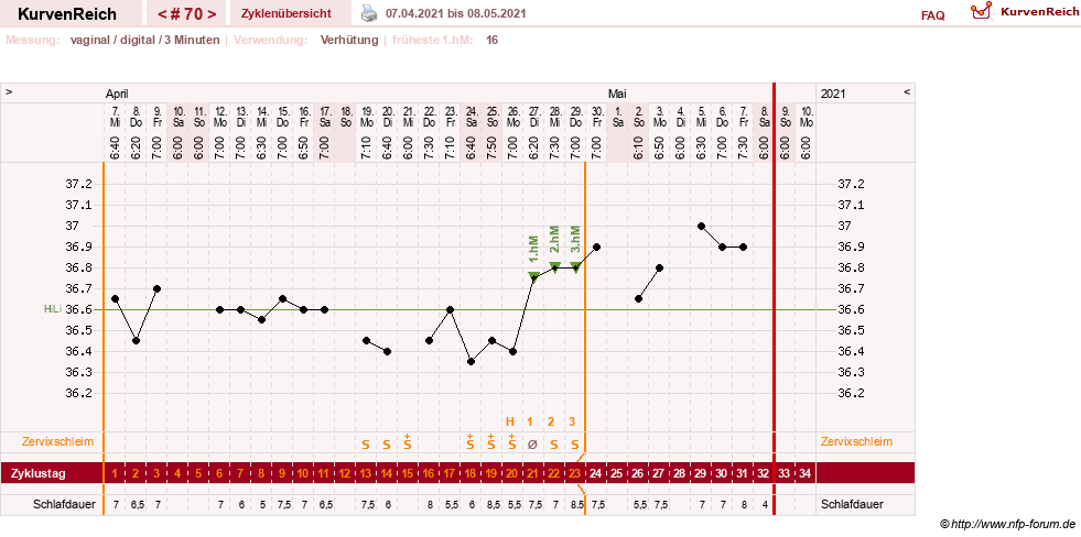 NFP-Kurve User #27863