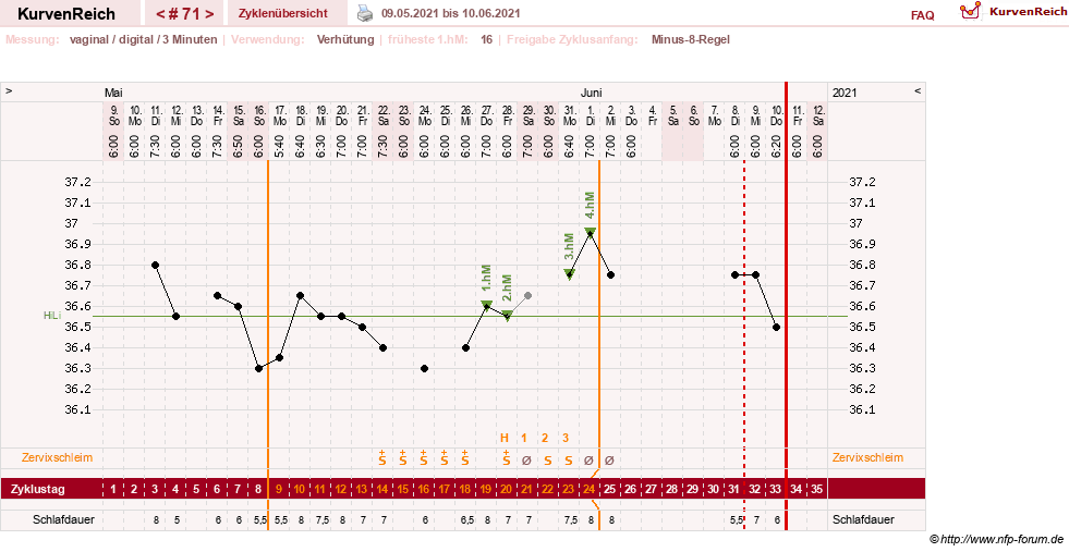 NFP-Kurve User #27863
