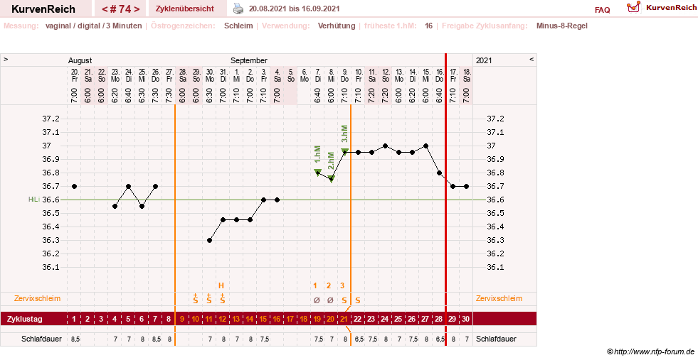 NFP-Kurve User #27863