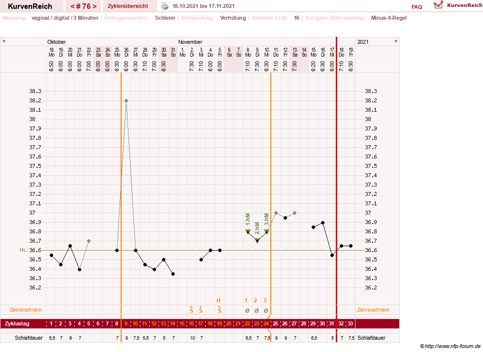 NFP-Kurve User #27863