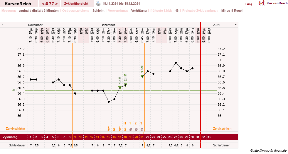 NFP-Kurve User #27863