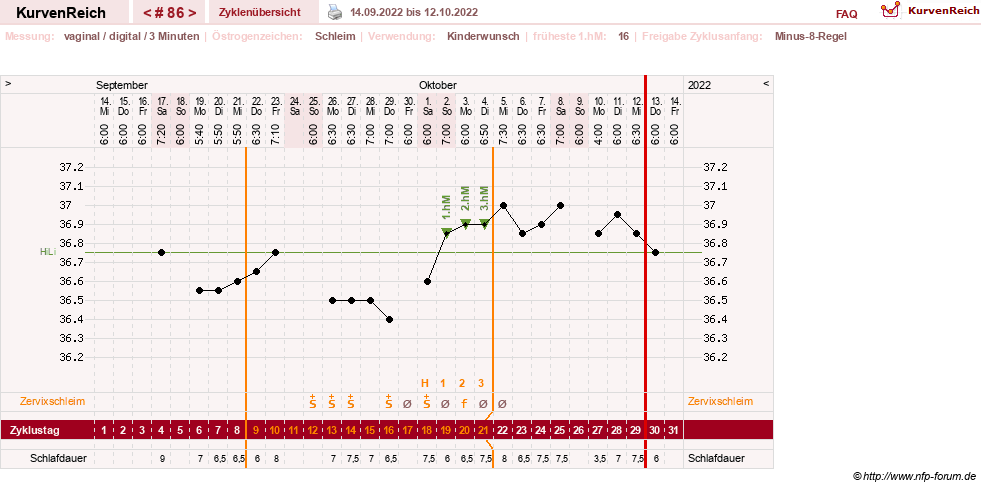 NFP-Kurve User #27863