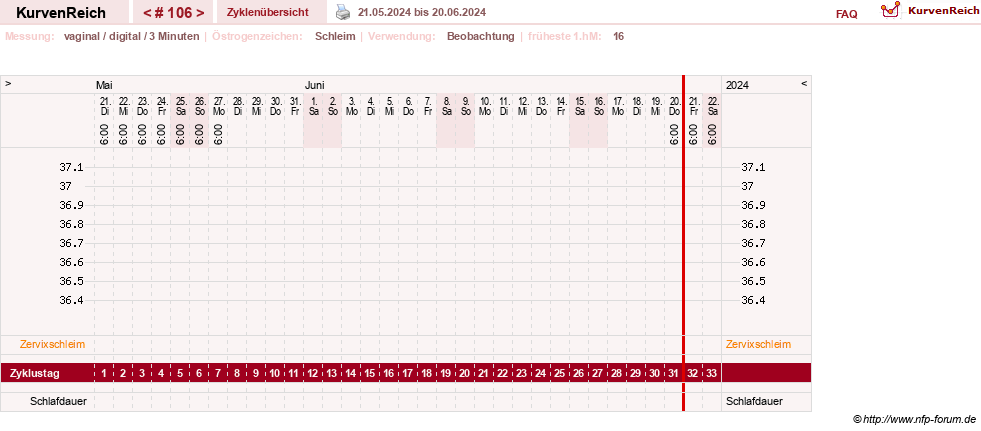 NFP-Kurve User #27863