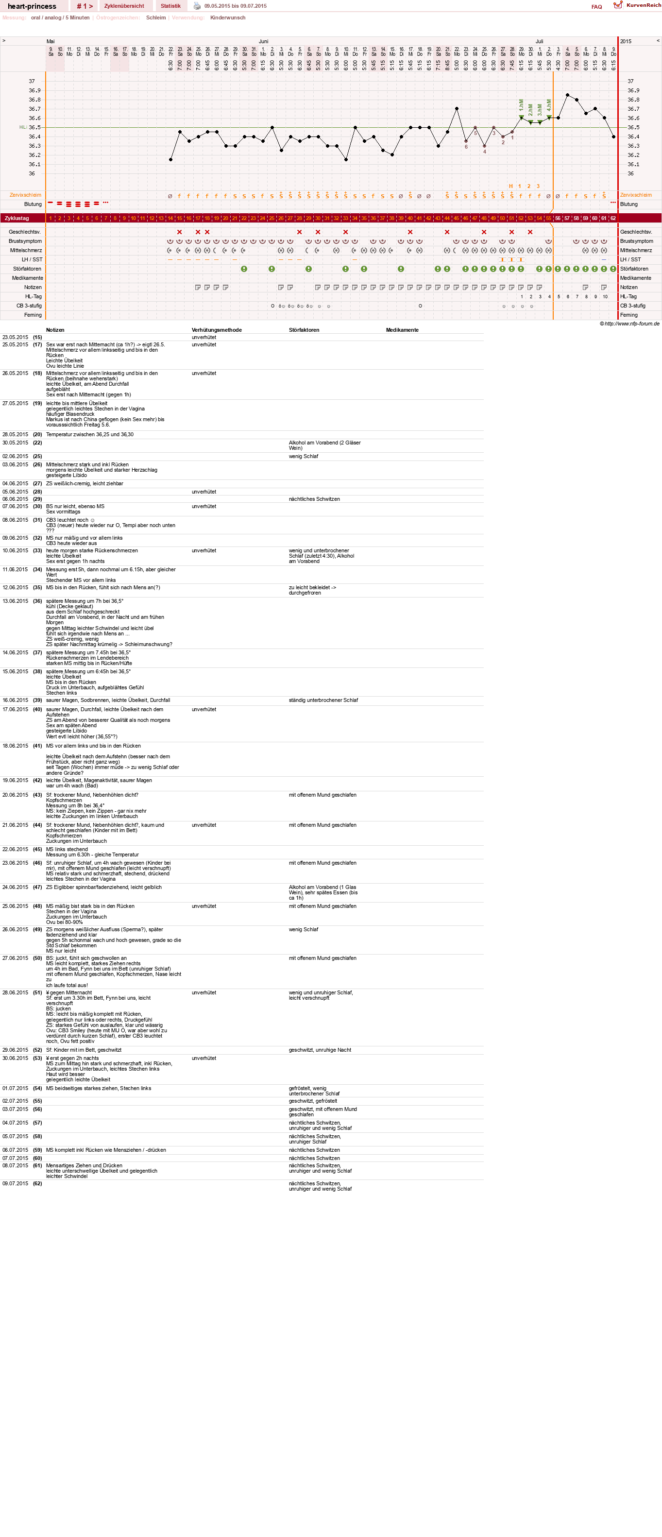 NFP-Kurve User #28034