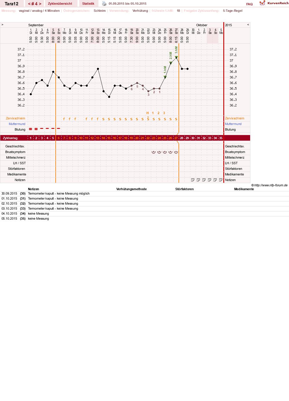 NFP-Kurve User #28088