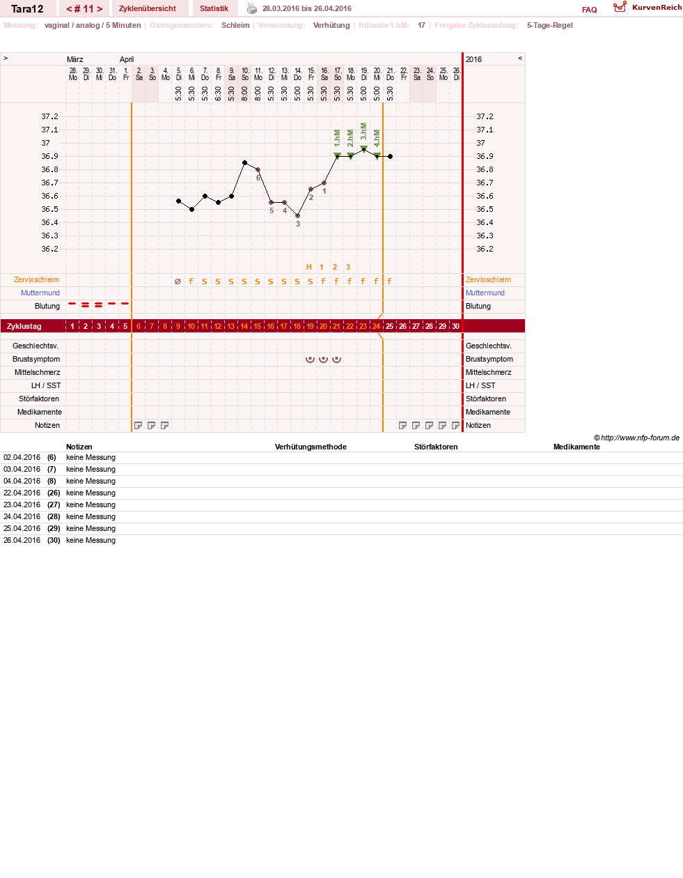 NFP-Kurve User #28088