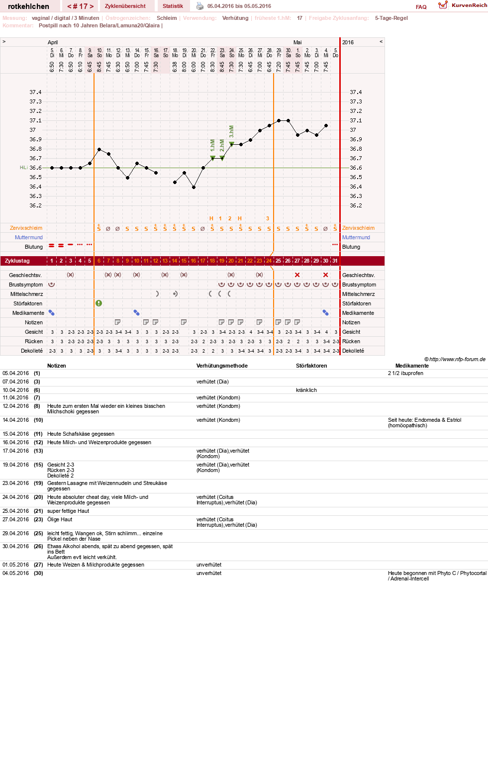 NFP-Kurve User #28094