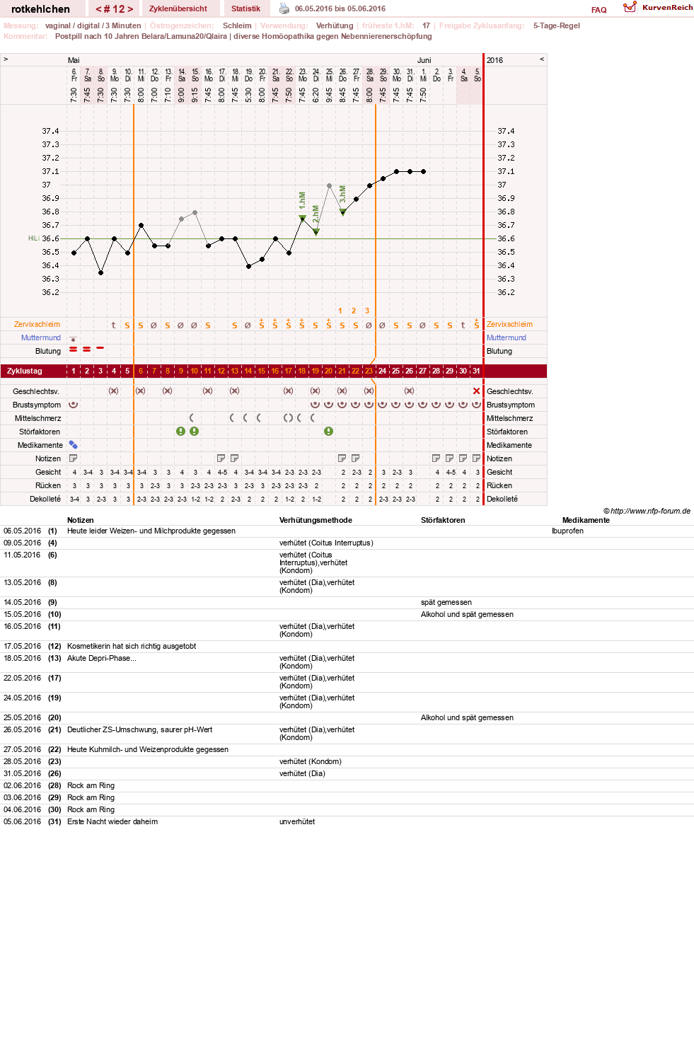 NFP-Kurve User #28094