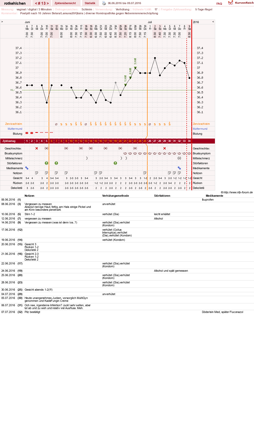 NFP-Kurve User #28094