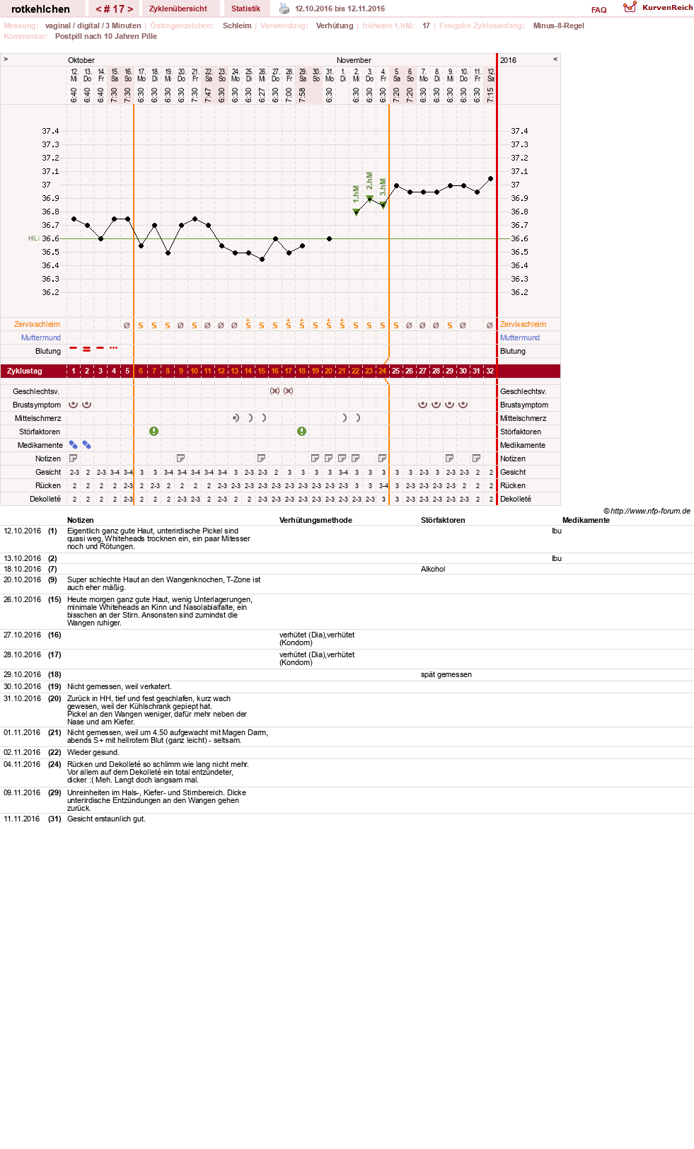 NFP-Kurve User #28094