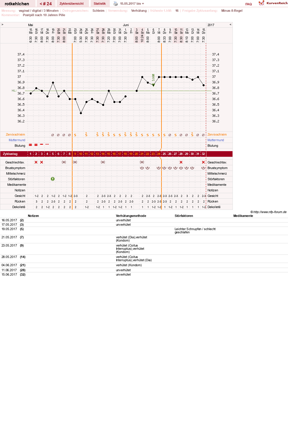 NFP-Kurve User #28094