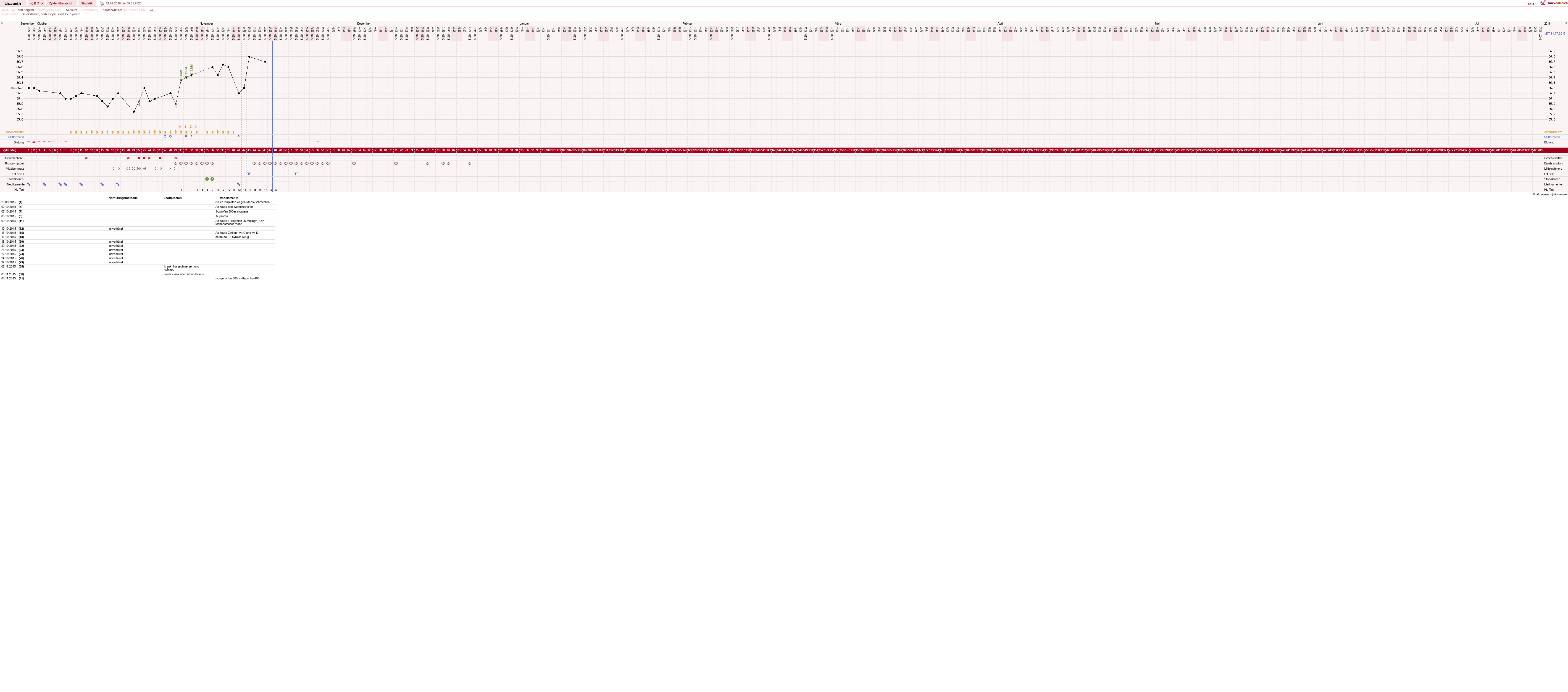 NFP-Kurve User #28148
