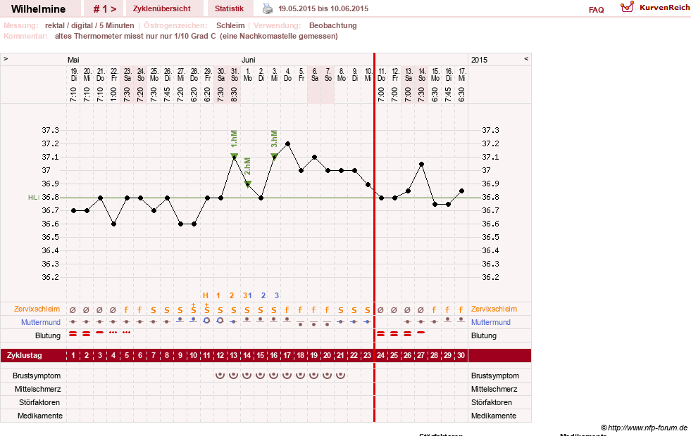 NFP-Kurve User #28188