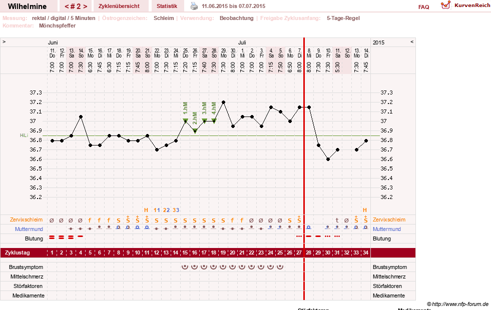 NFP-Kurve User #28188