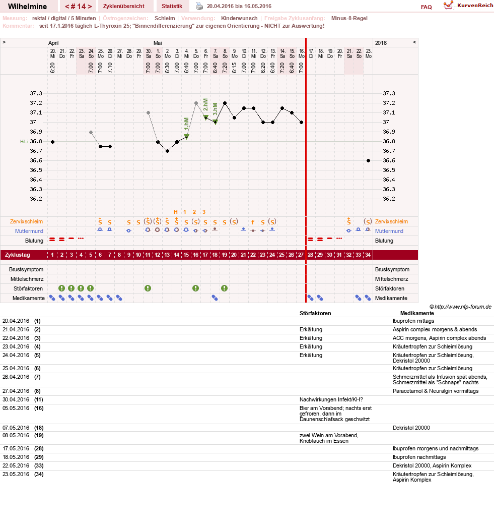 NFP-Kurve User #28188