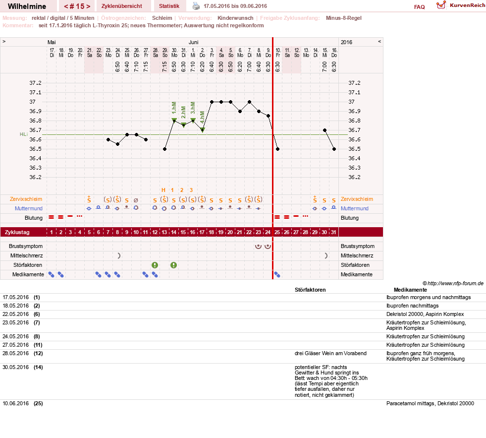 NFP-Kurve User #28188