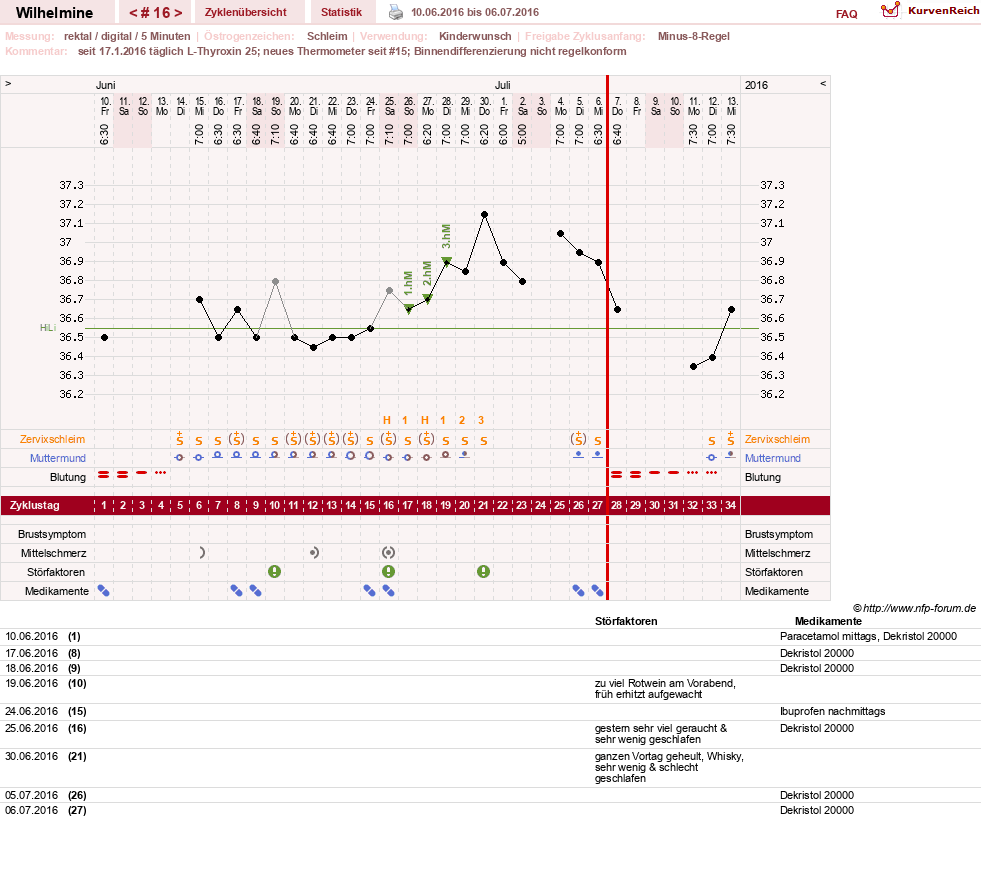 NFP-Kurve User #28188