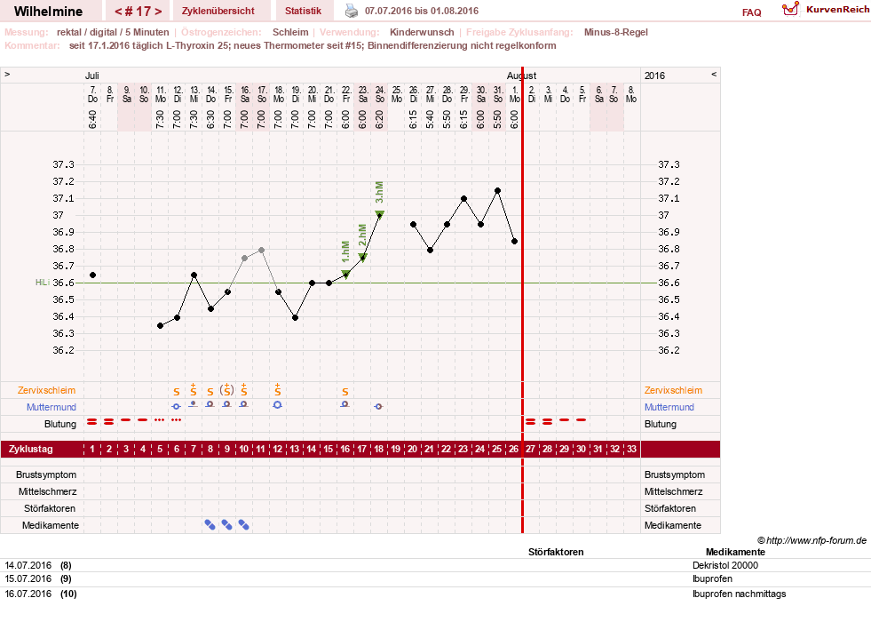 NFP-Kurve User #28188