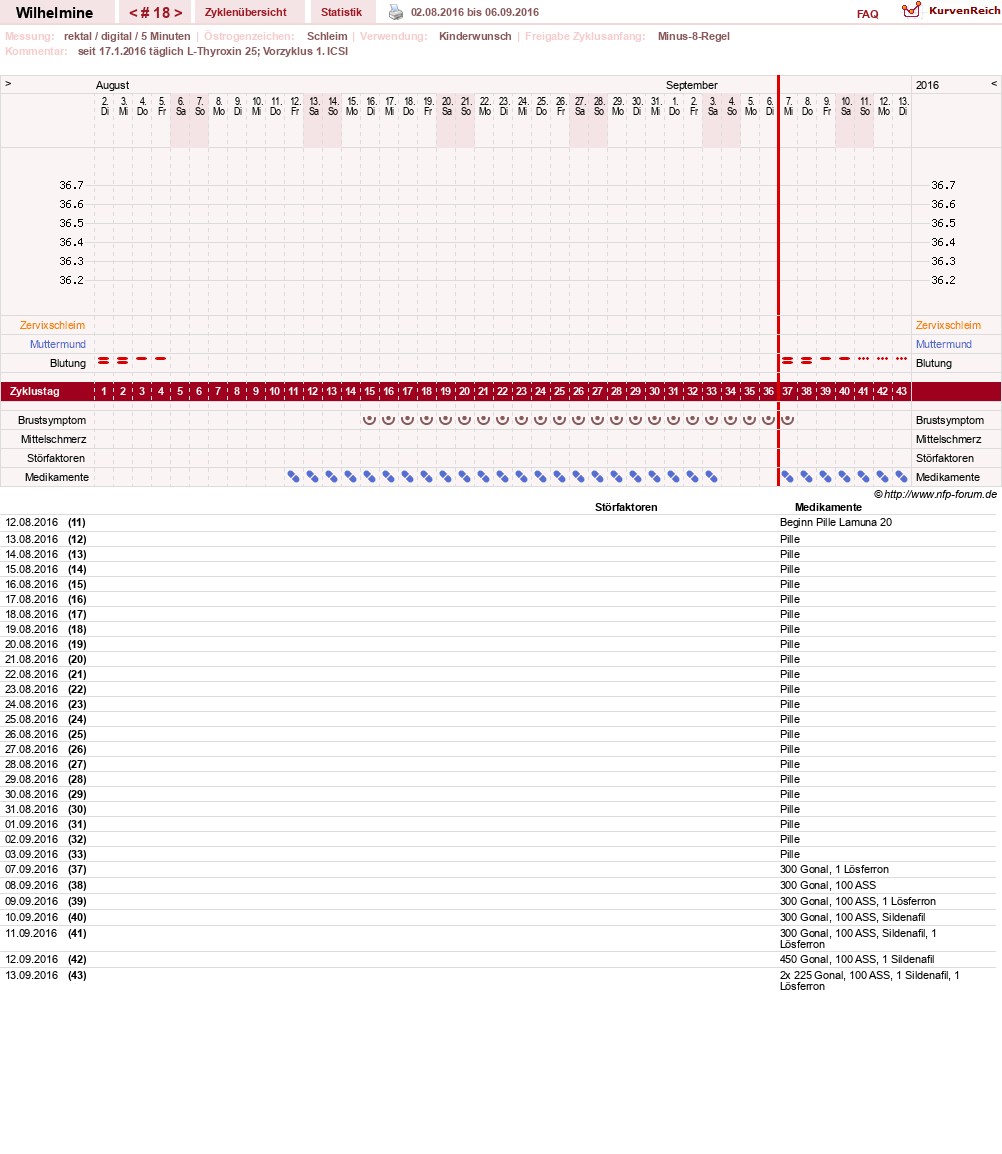 NFP-Kurve User #28188
