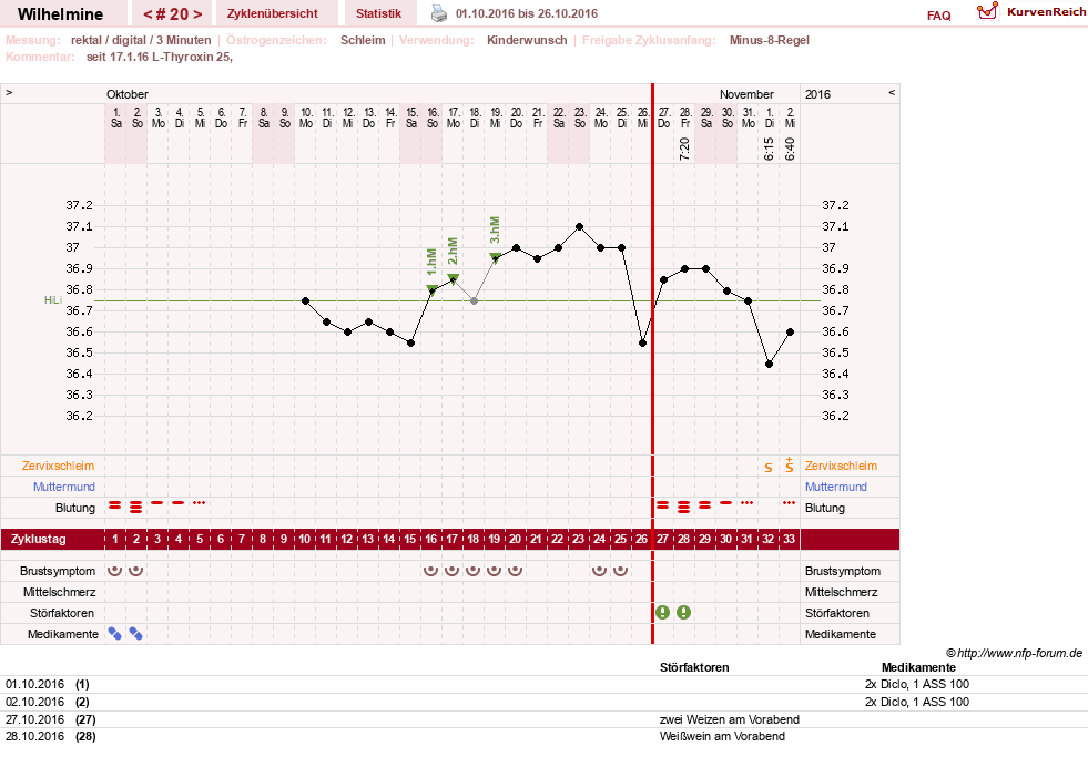 NFP-Kurve User #28188