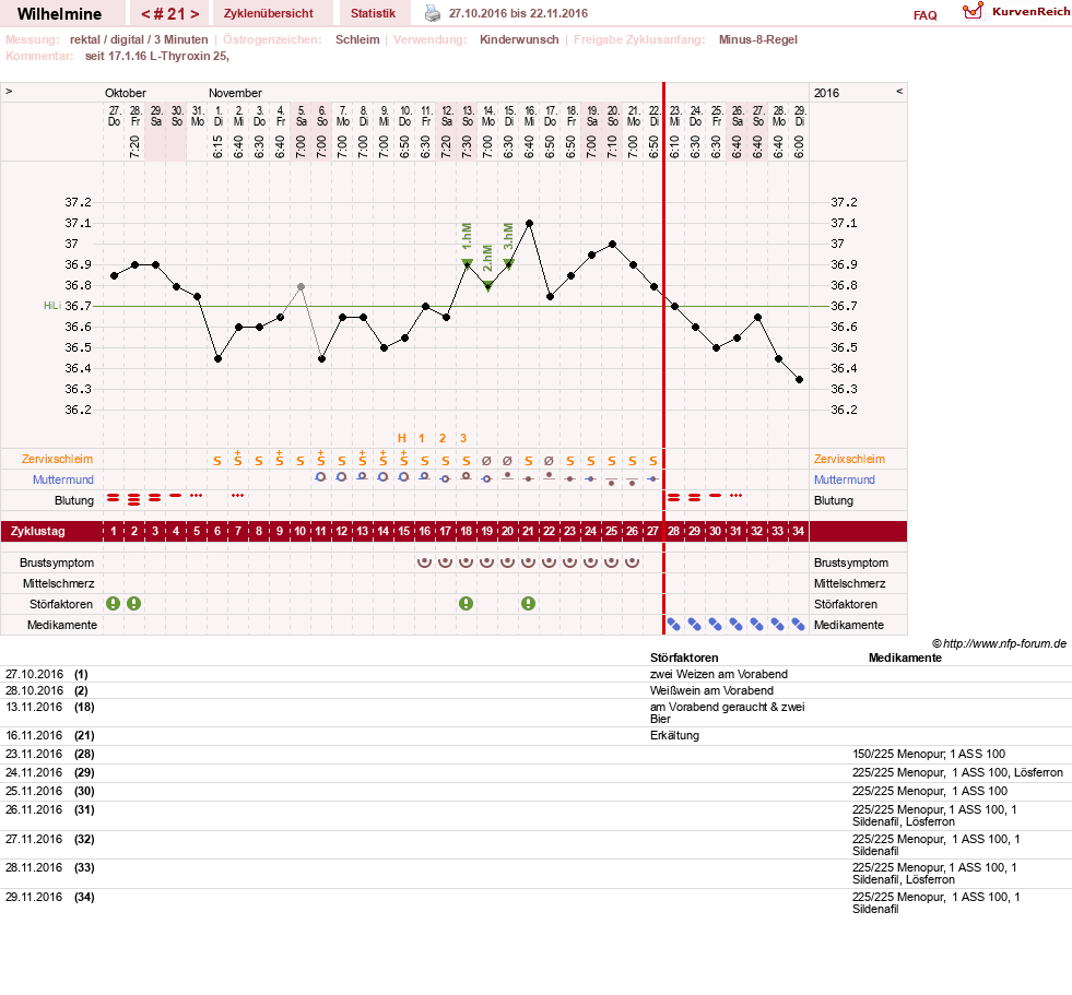 NFP-Kurve User #28188