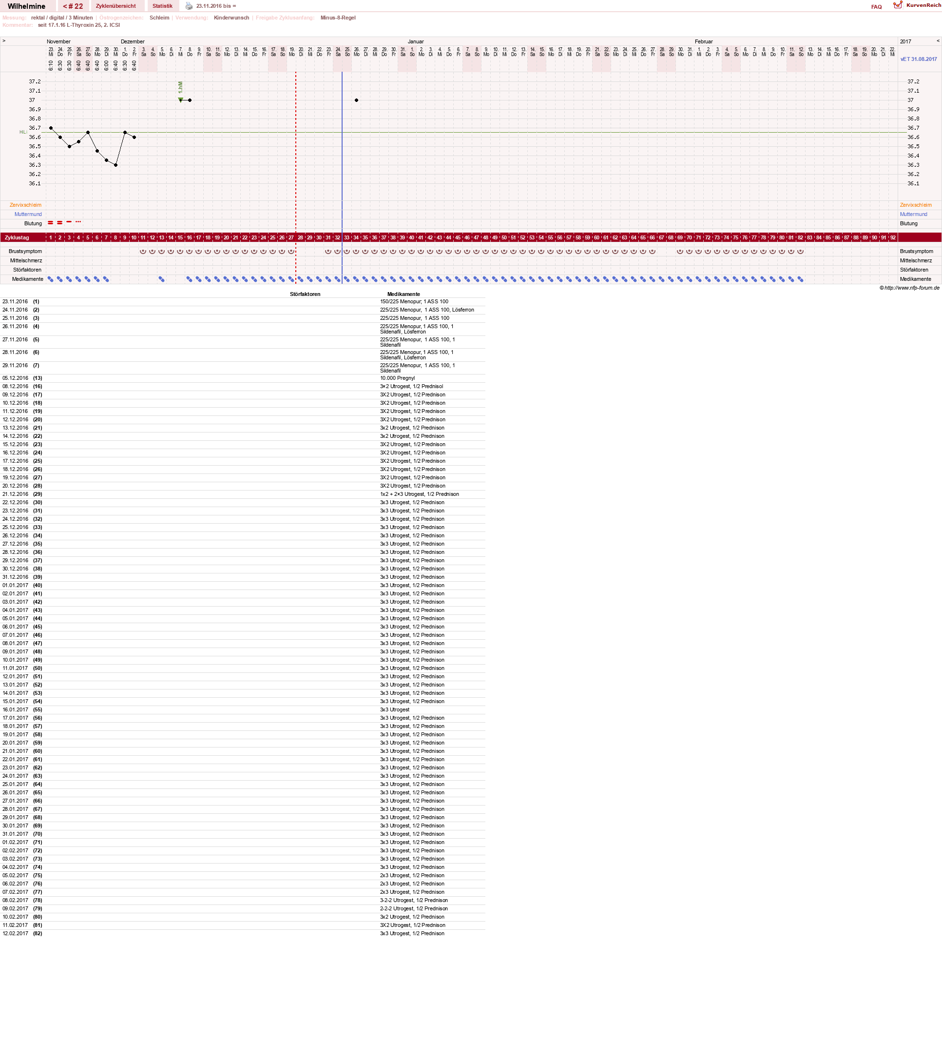 NFP-Kurve User #28188