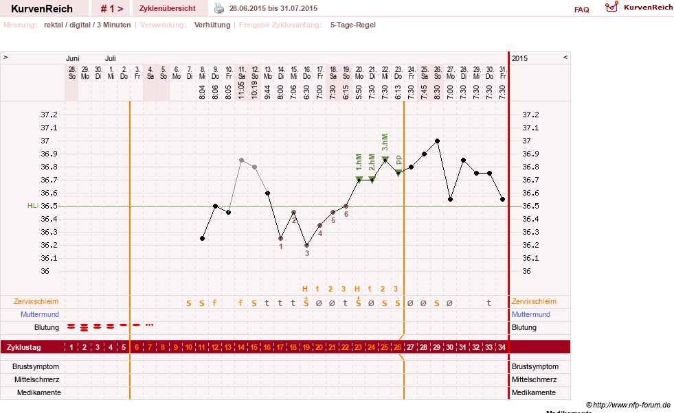 NFP-Kurve User #28211