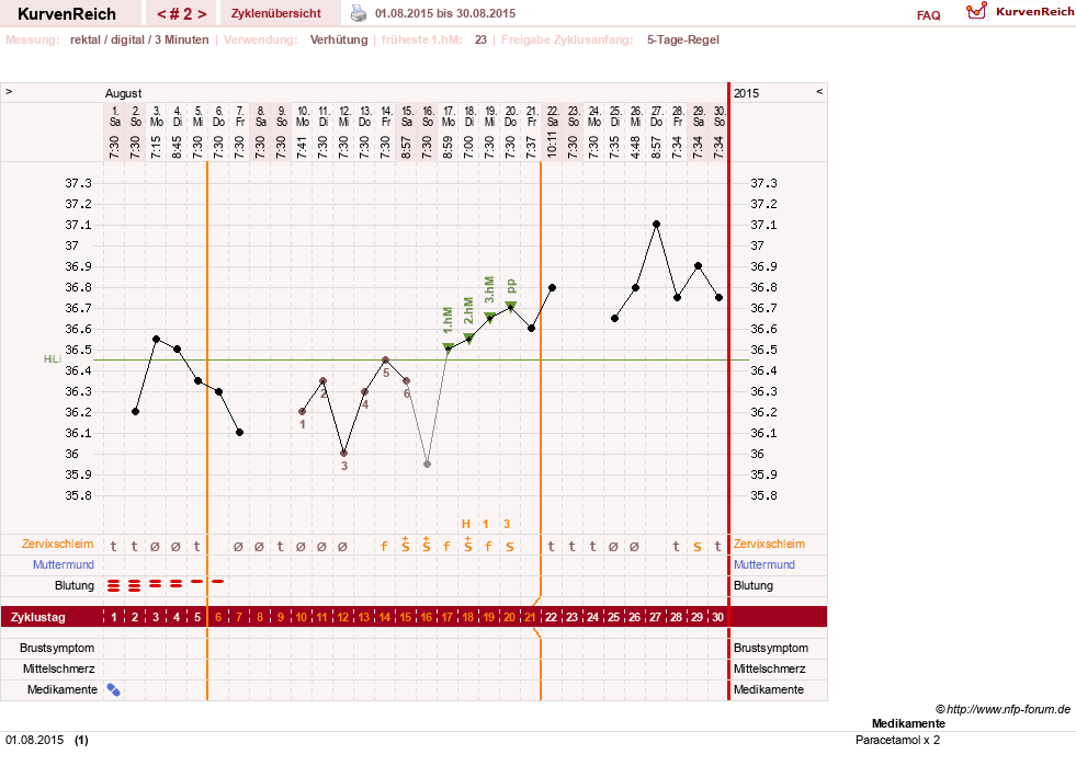 NFP-Kurve User #28211