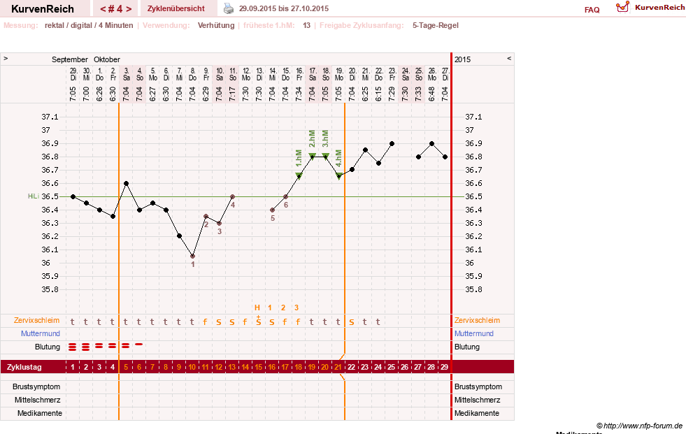 NFP-Kurve User #28211
