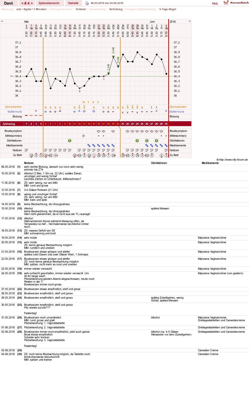 NFP-Kurve User #28284