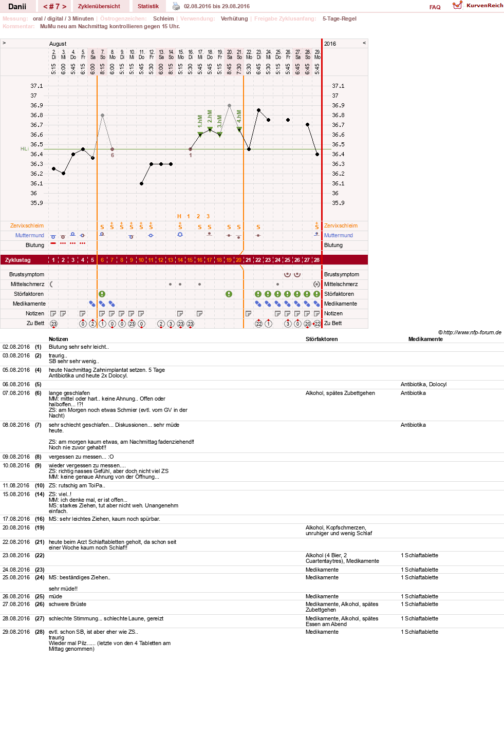NFP-Kurve User #28284