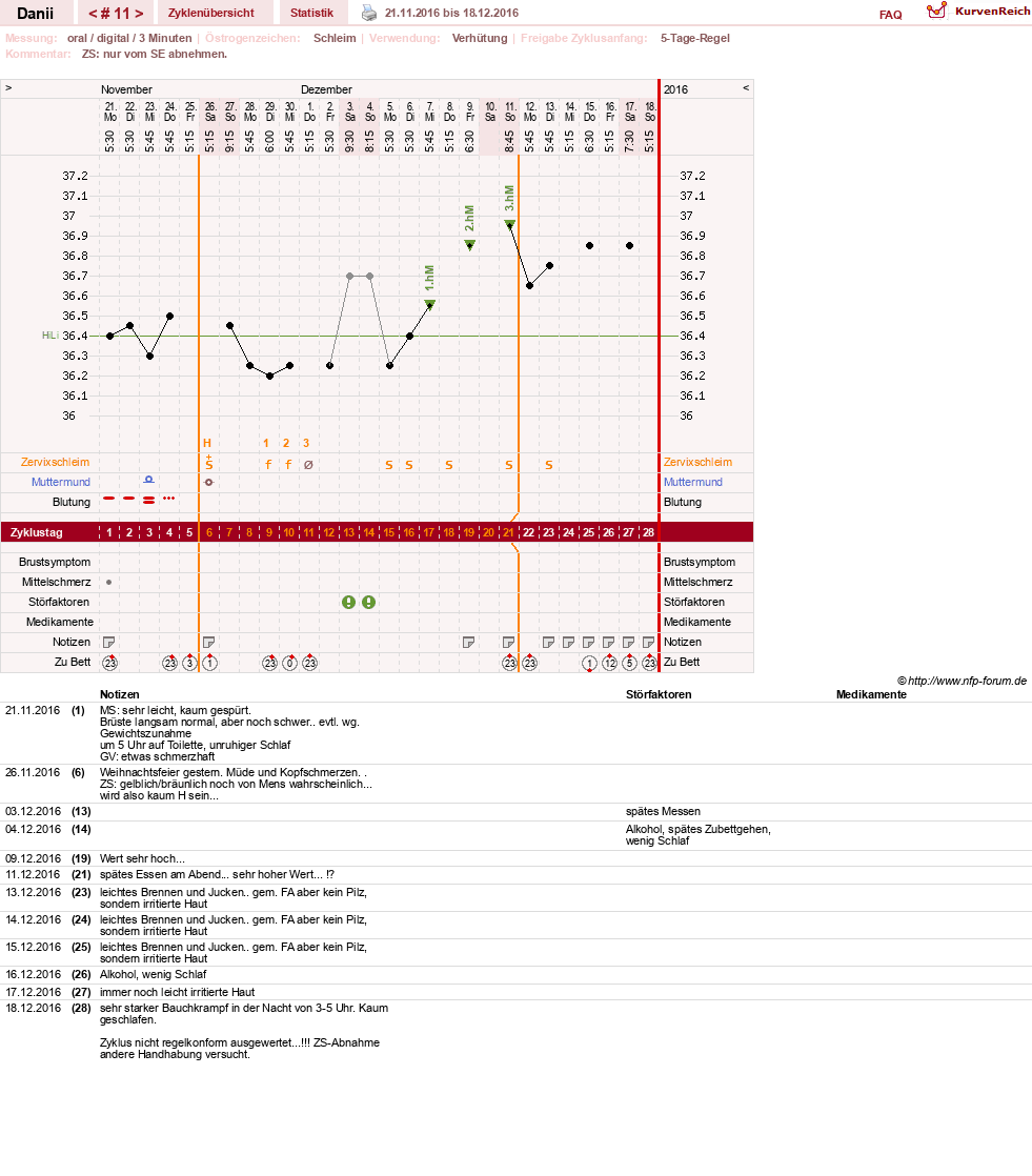 NFP-Kurve User #28284