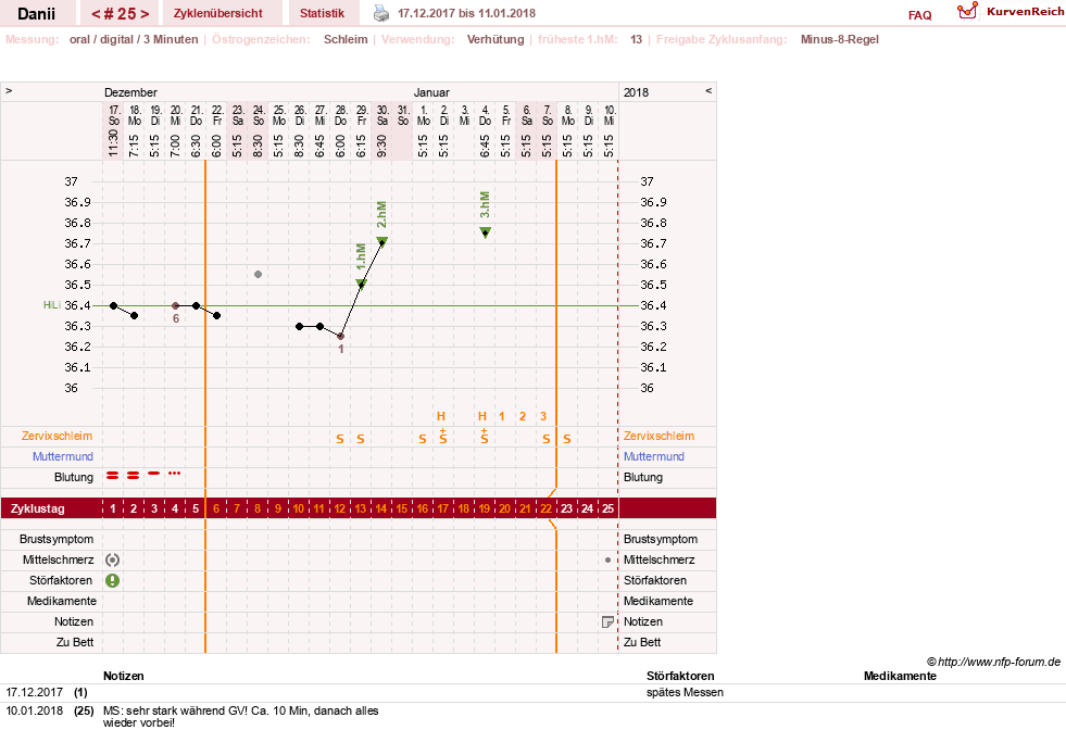 NFP-Kurve User #28284