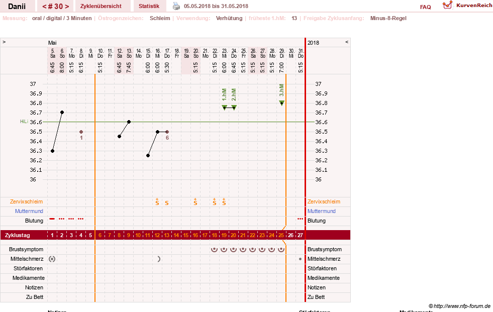 NFP-Kurve User #28284