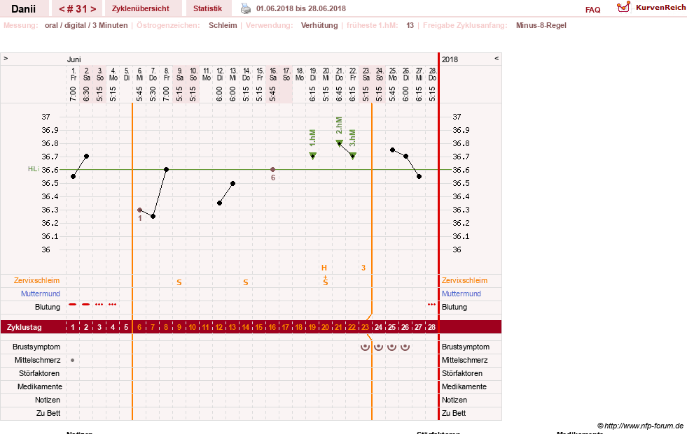 NFP-Kurve User #28284
