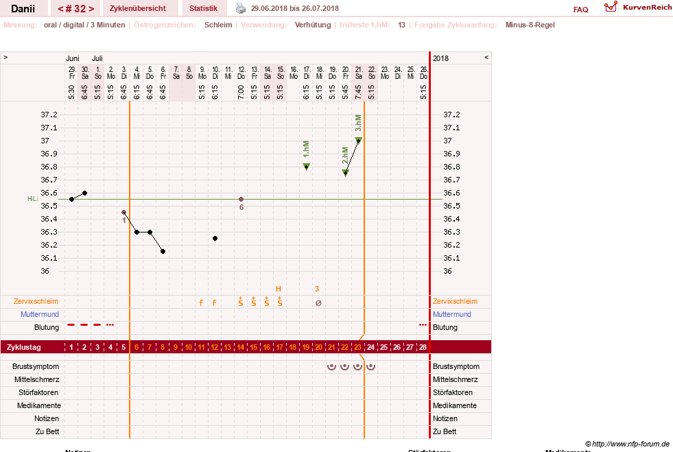 NFP-Kurve User #28284