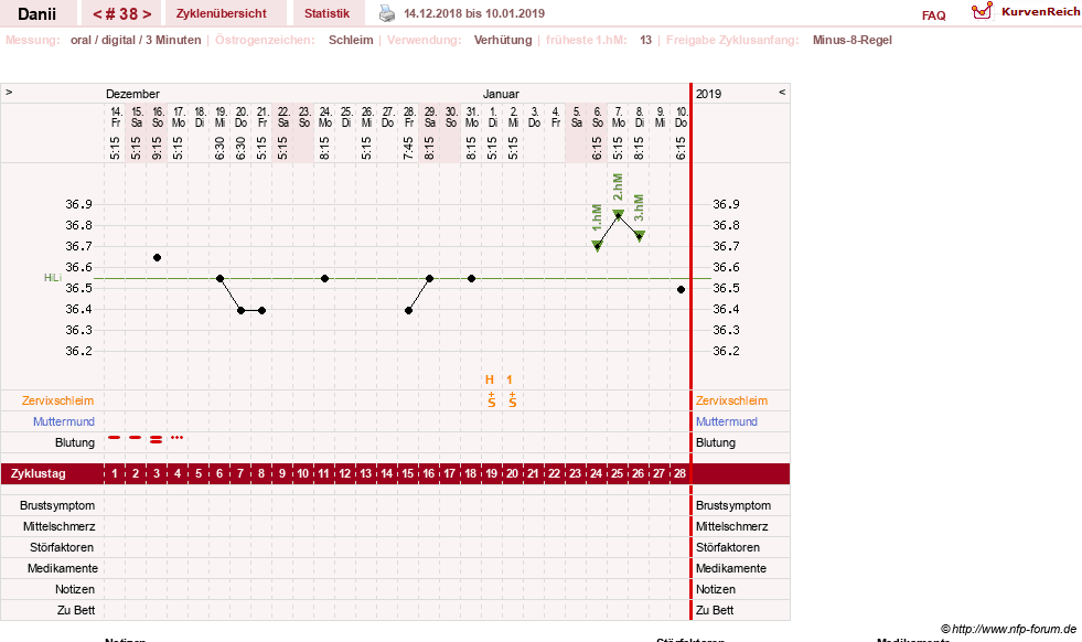 NFP-Kurve User #28284