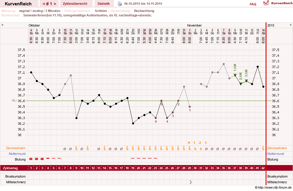 NFP-Kurve User #28365