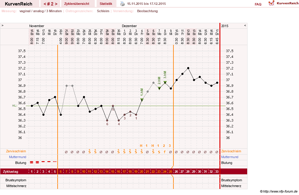 NFP-Kurve User #28365