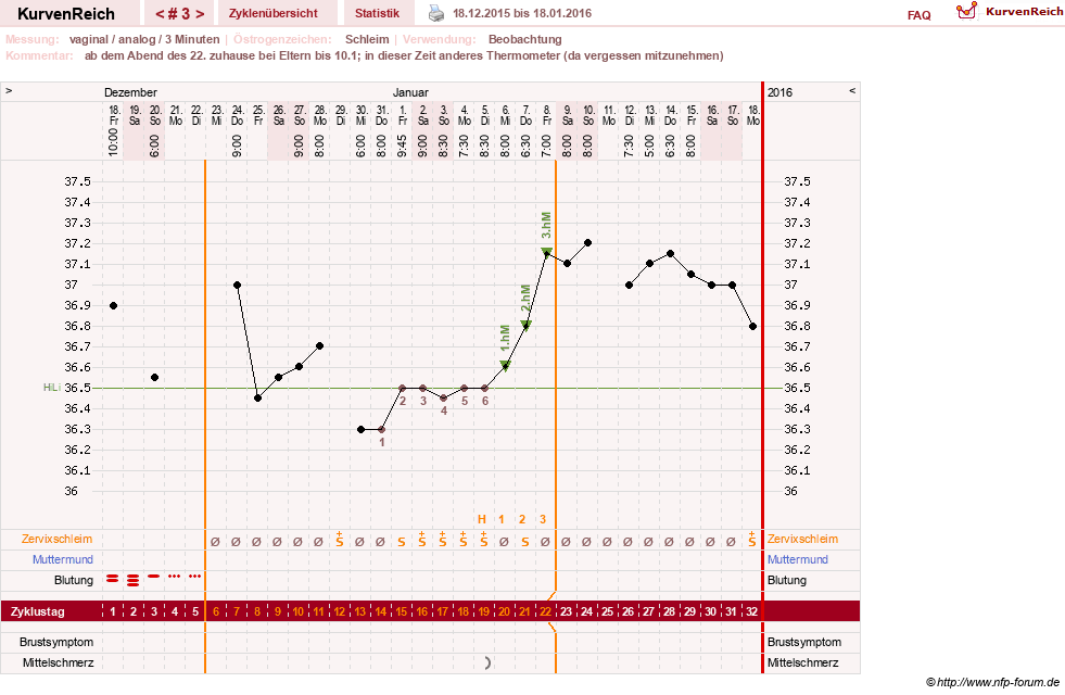 NFP-Kurve User #28365