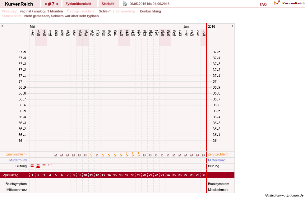 NFP-Kurve User #28365