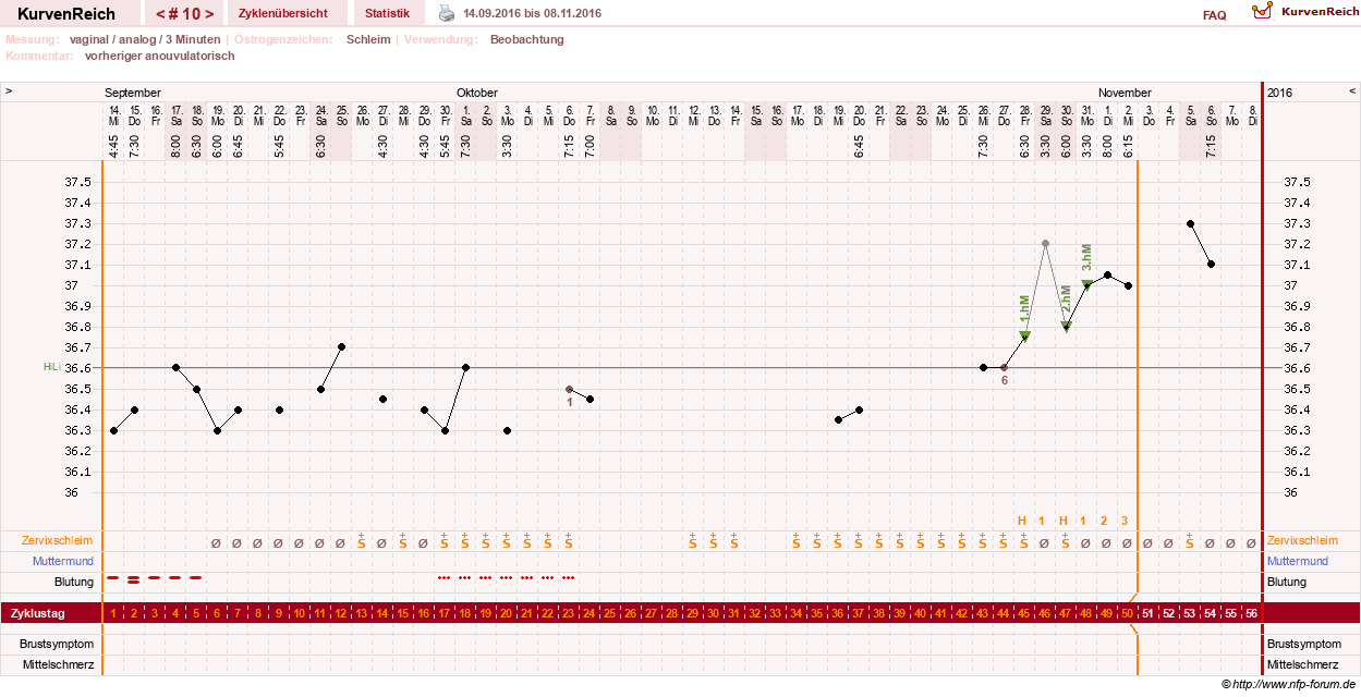 NFP-Kurve User #28365